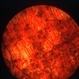 Choroidal atrophy Choroidal atrophy